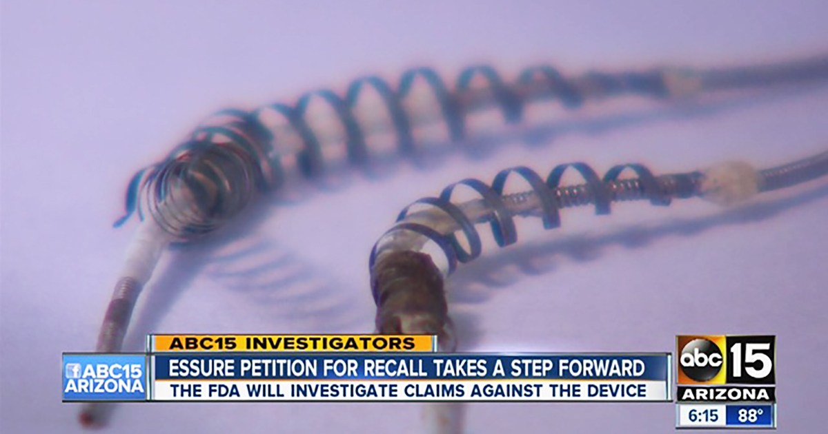 Pennsylvania Congressman Introduces Bill to Ban Defective Essure Birth Control Device