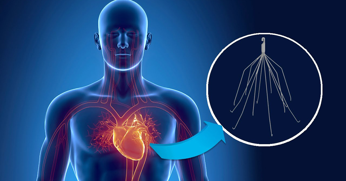 NBC Exposes CW Bard and FDA for Fraud and Incompetence Over IVC Filters