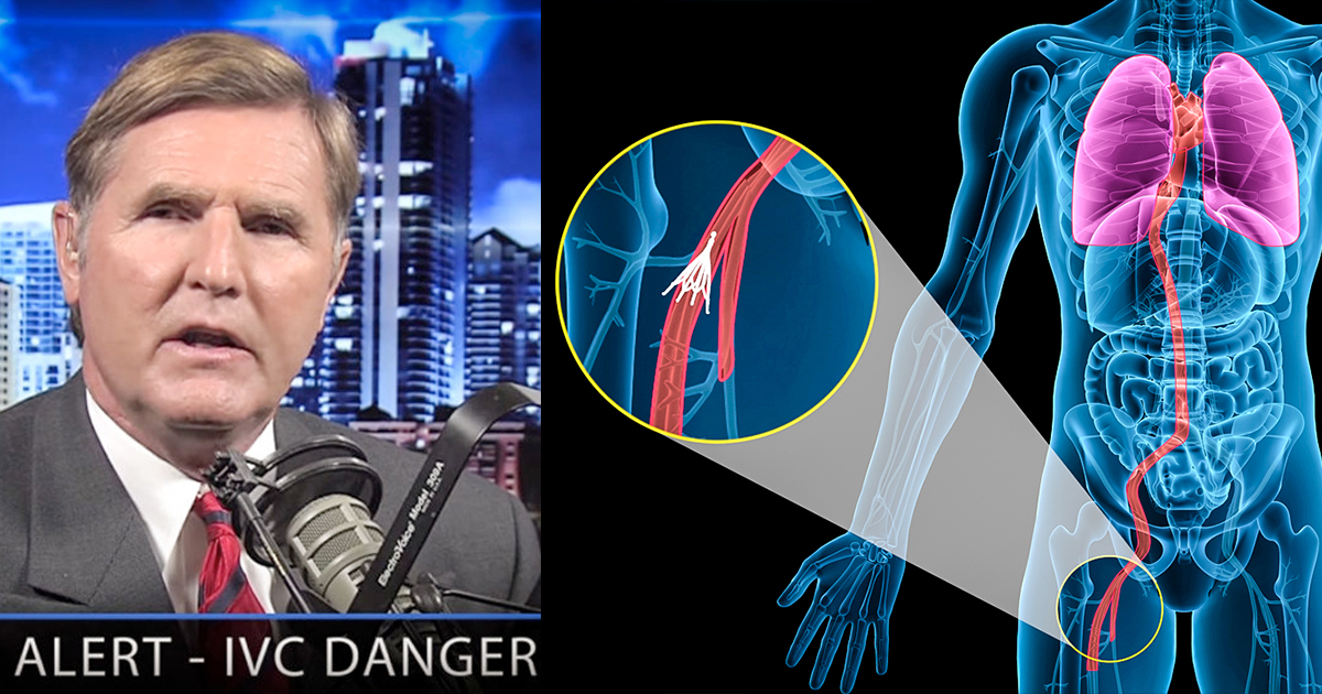 IVC Filter Lawsuits Are Rising Because of High Failure Rates & Injuries