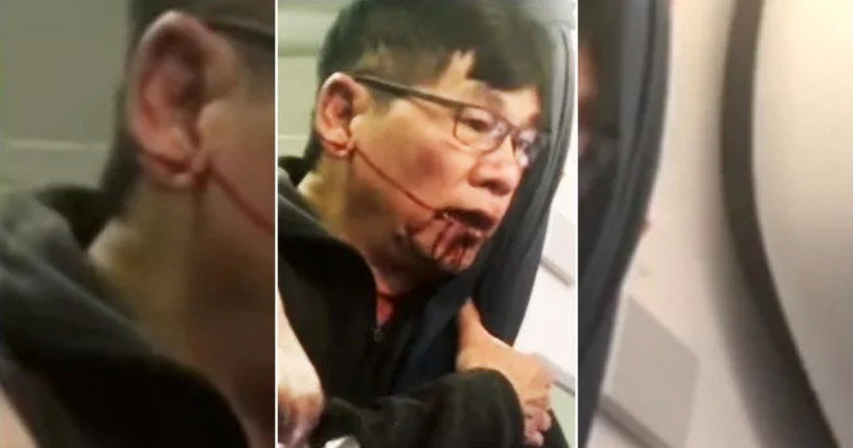 Lawyer For United Victim Details Extensive Injuries, Says They’ll “Probably” Sue