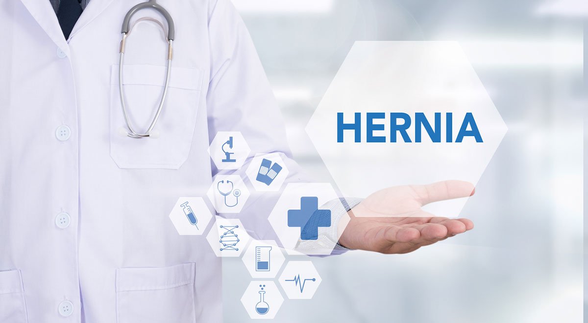 Despite Growing Lawsuits and Injuries, the Hernia Mesh Market is Expected to Grow